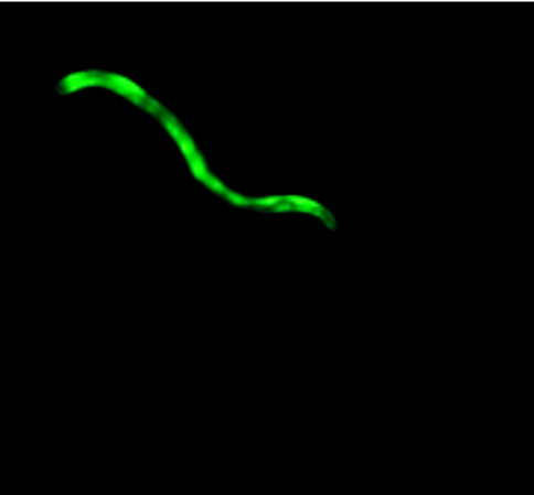 Fluorescence image of a C. elegans human model worm taken by the SydLab System Organism-on-Chip Technology