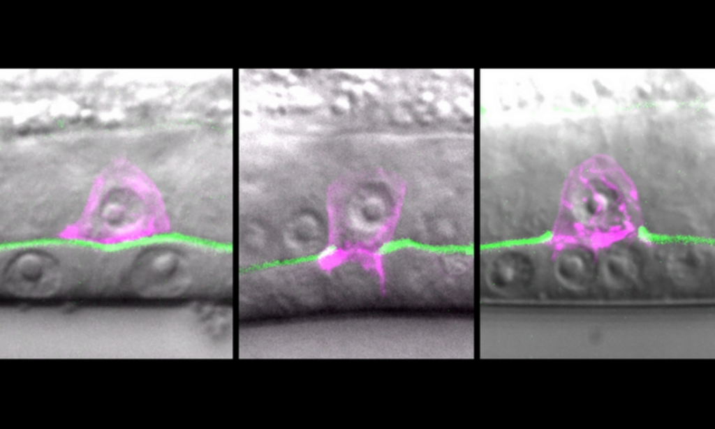 A 'Parts List' for cancer's spread: Worms to fight metastasis