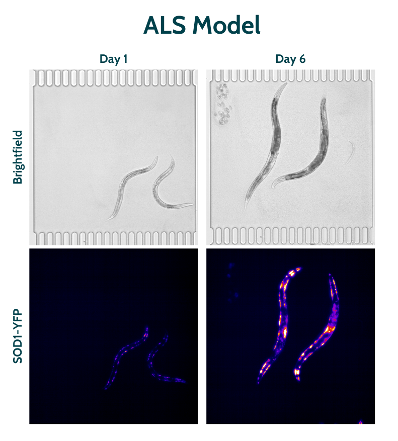 Protein aggregation ALS model